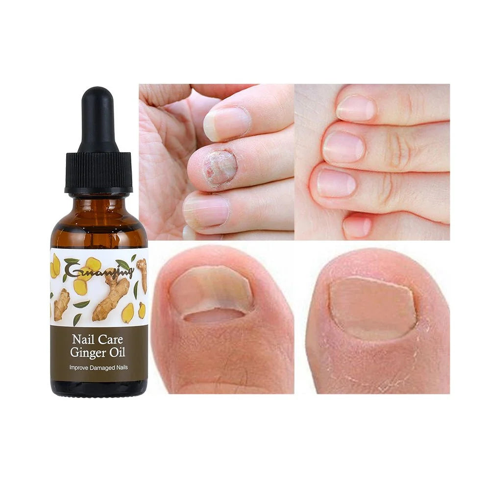Guanjing Nail Care Ginger Oil | Repairs, Strengthens & Promotes Nail Growth | 30ml