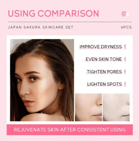 Japan Sakura Skincare Set – 6 Pieces