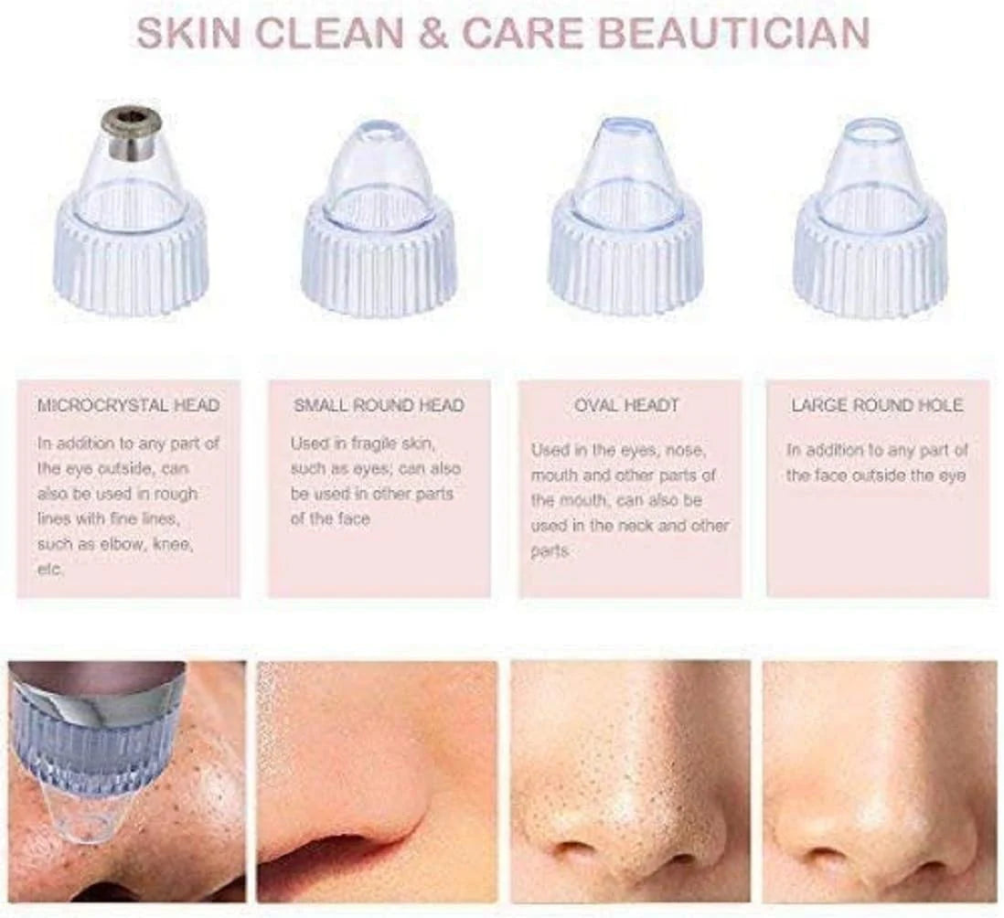 Pore Vacuum Blackhead Remover | 5-Level Suction with 4 Probes for All Skin Types